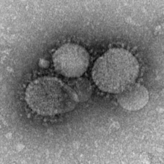 Imagen del virus MERS-CoV, un tipo de coronavirus.