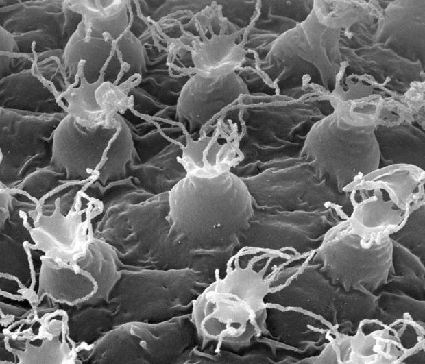 Detalle de la superficie de un huevo de tardígrado de la especie Macrobiotus shonaicus. Crédito de la foto: Daniel Stec et al.