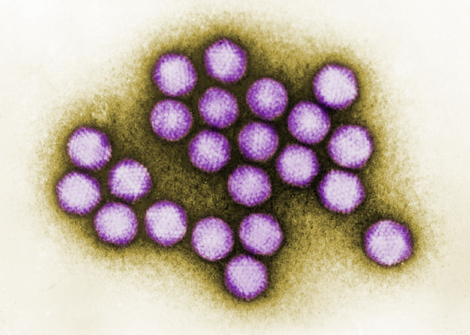Imagen coloreada de Adenovirus, obtenida por microfotografía electrónica. Crédito: Public Health Image Library.