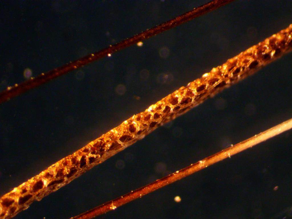 Pelos especializados vs pelos normales de la rata crestada africana (Lophiomys imhausi)